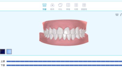 毛利高達70%，隱形牙套的千億市場，誰在買單？